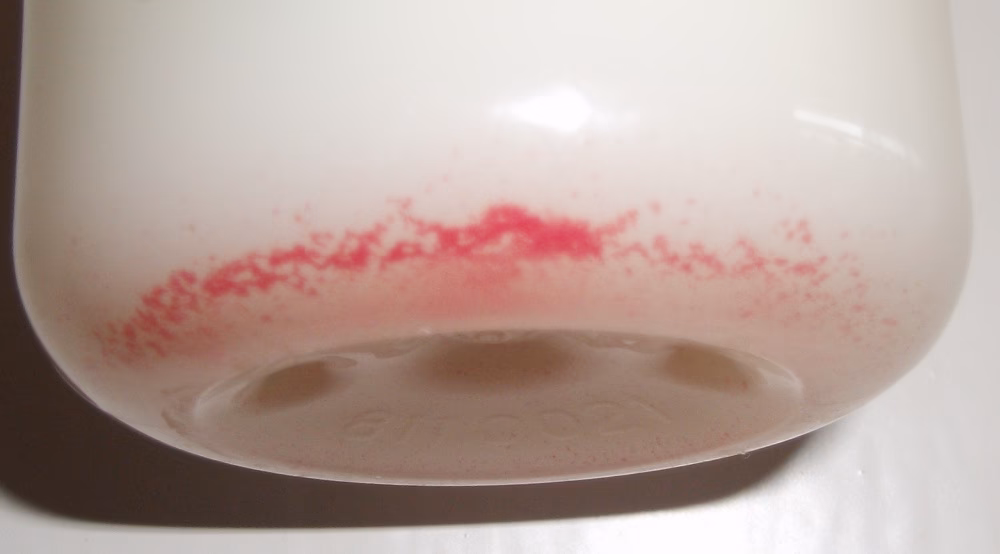 Wat zijn de oorzaken van bloed in moedermelk?